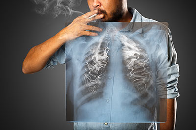 COPDという病気を知っていますか